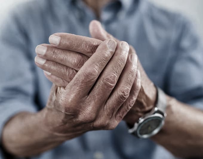 Case History – Rheumatic Joint Pains