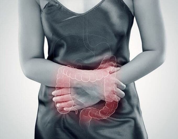 Irritable Bowel Syndrome (IBS)