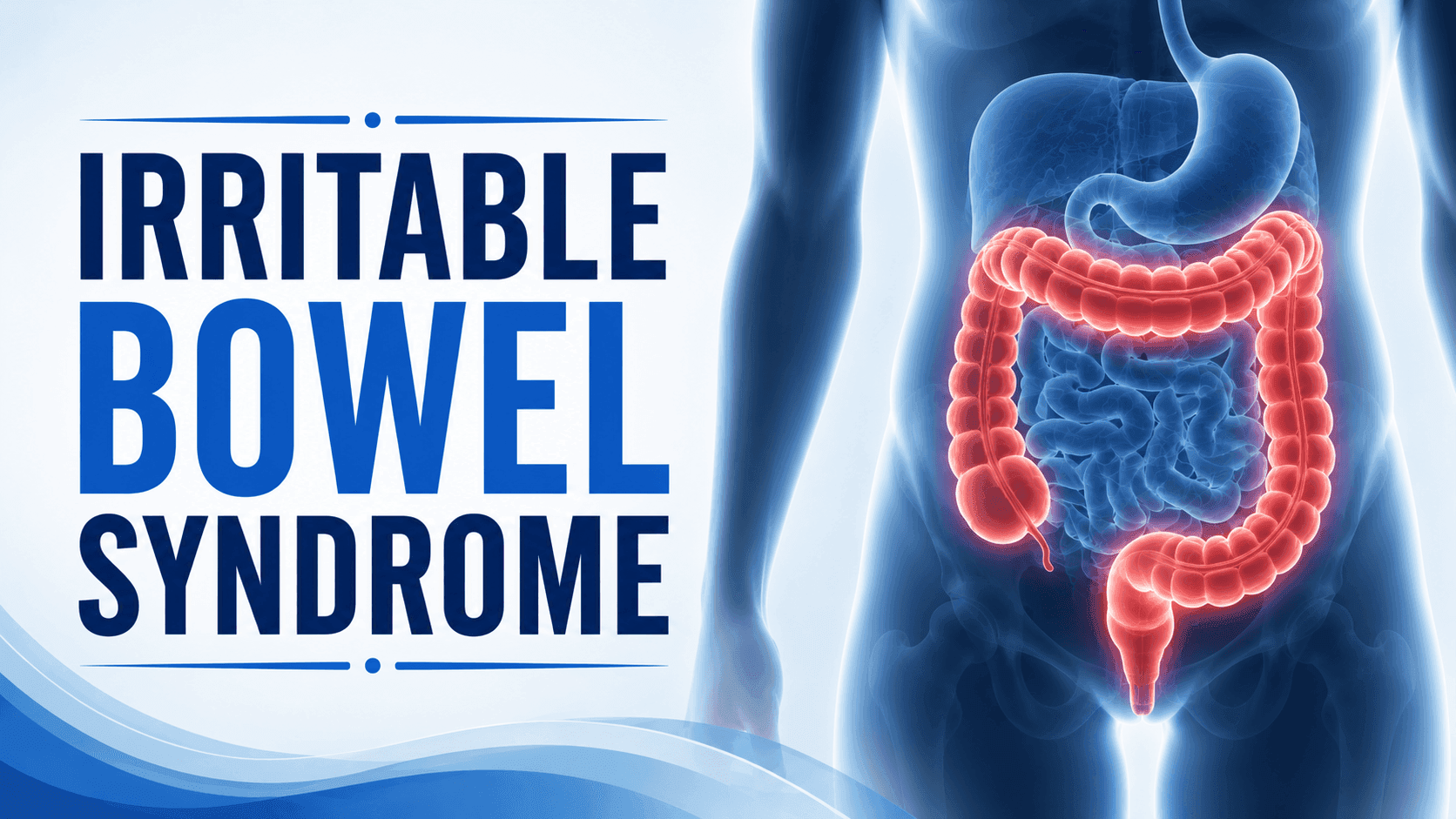 Irritable Bowel Syndrome