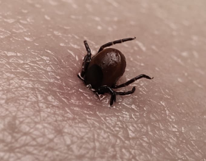 Lyme Disease