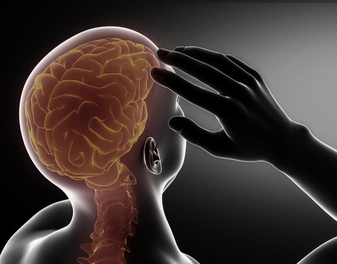 Neurological Disorders