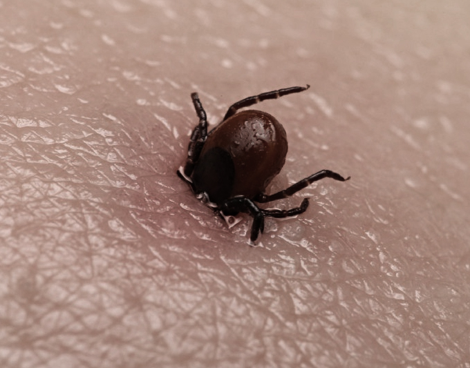 Dengue Fever treatment placeholder